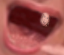 :Salame_dent: