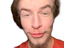 :Talmo_le_neuille_puant_: