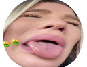 :Beurkk: