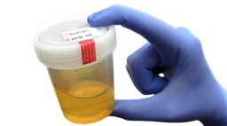 :Urine: