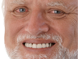 :harold: