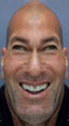 :Zidane_triso:
