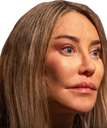 :botox2: