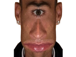 :Ronaldocyclope: