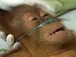 :singehopital: